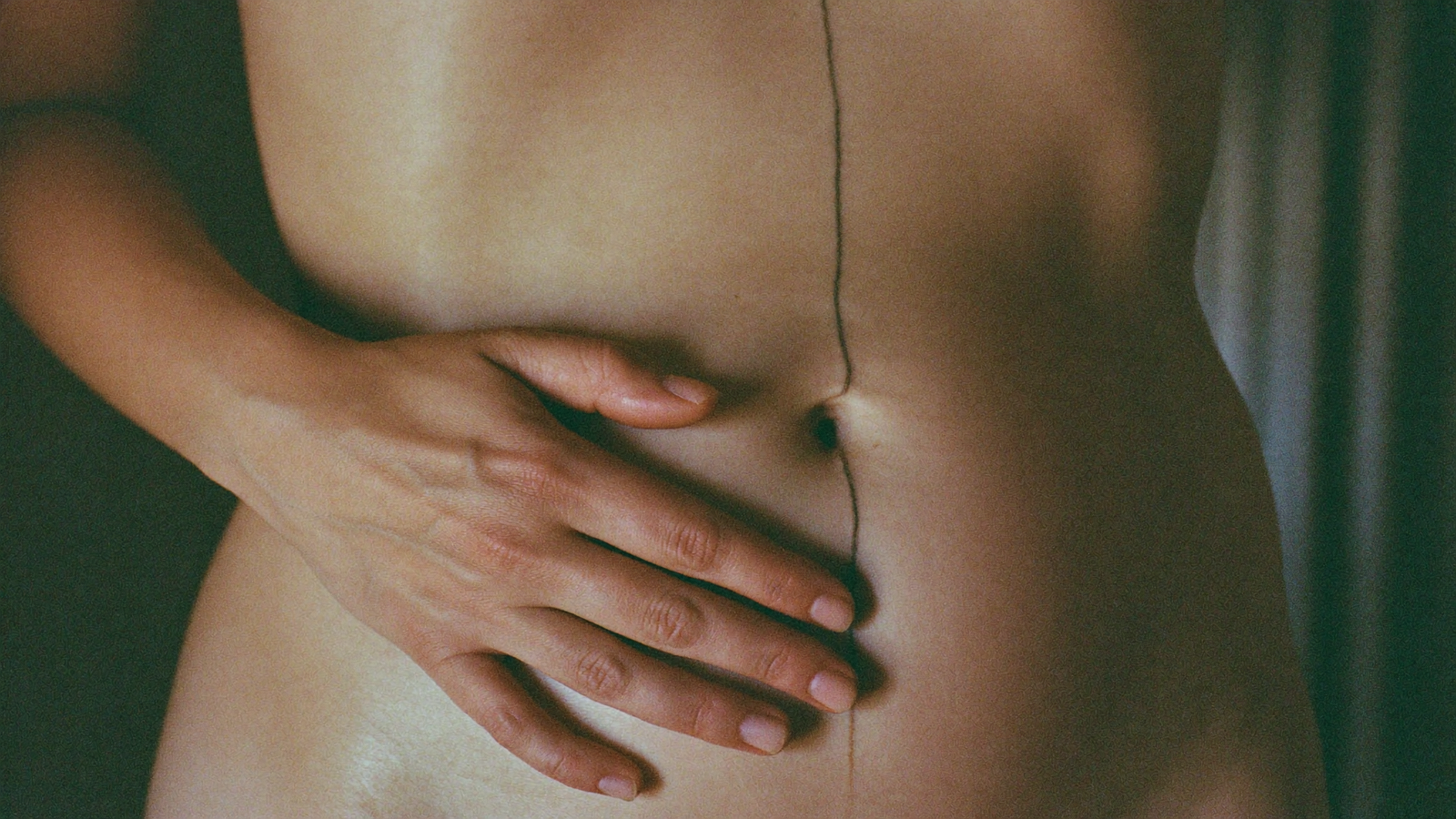 Linea nigra postpartum — soft belly with fading midline pigmentation