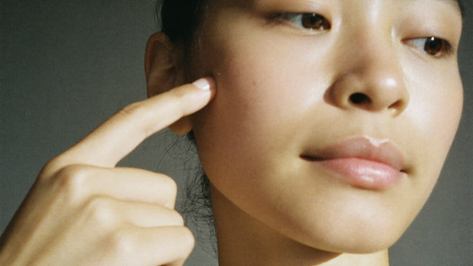 Melasma after pregnancy — postpartum cheek pigmentation