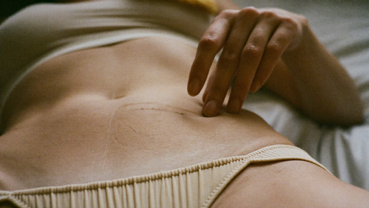 Healed c-section scar — gentle postpartum scar care
